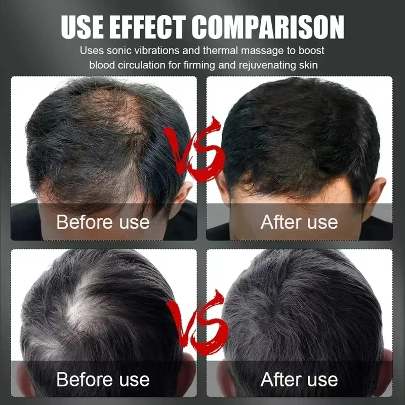 660nm 850nm Kırmızı Işık Kızıl - Hair Care incelemesi ve fiyatı